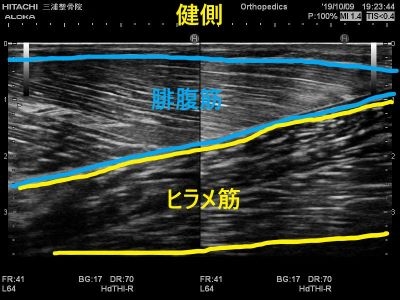 あ